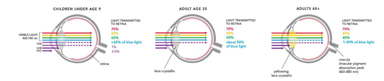 Blue light transmission to the retina: children under 9 vs adults 25 vs adults 60+